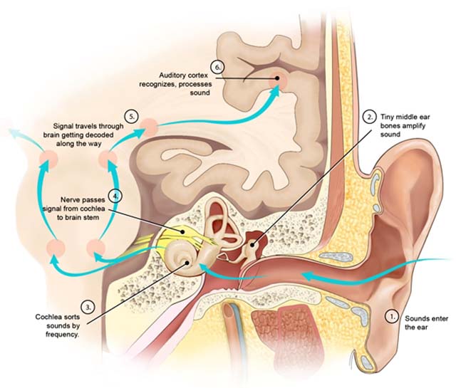 hearing loss after an accident - ear